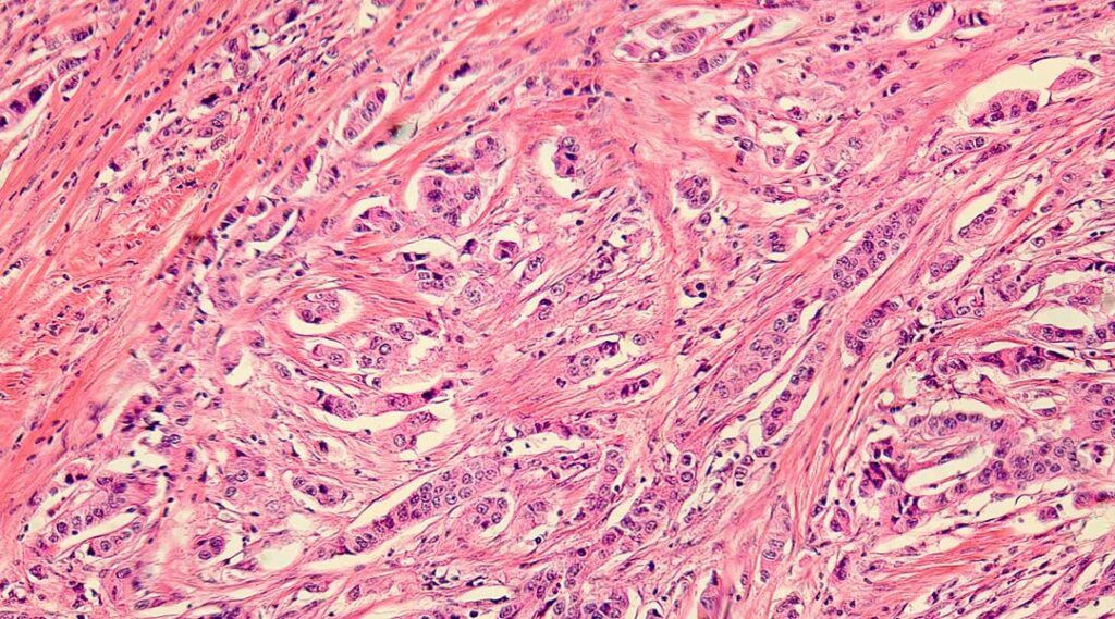 And Now for Something Completely Different